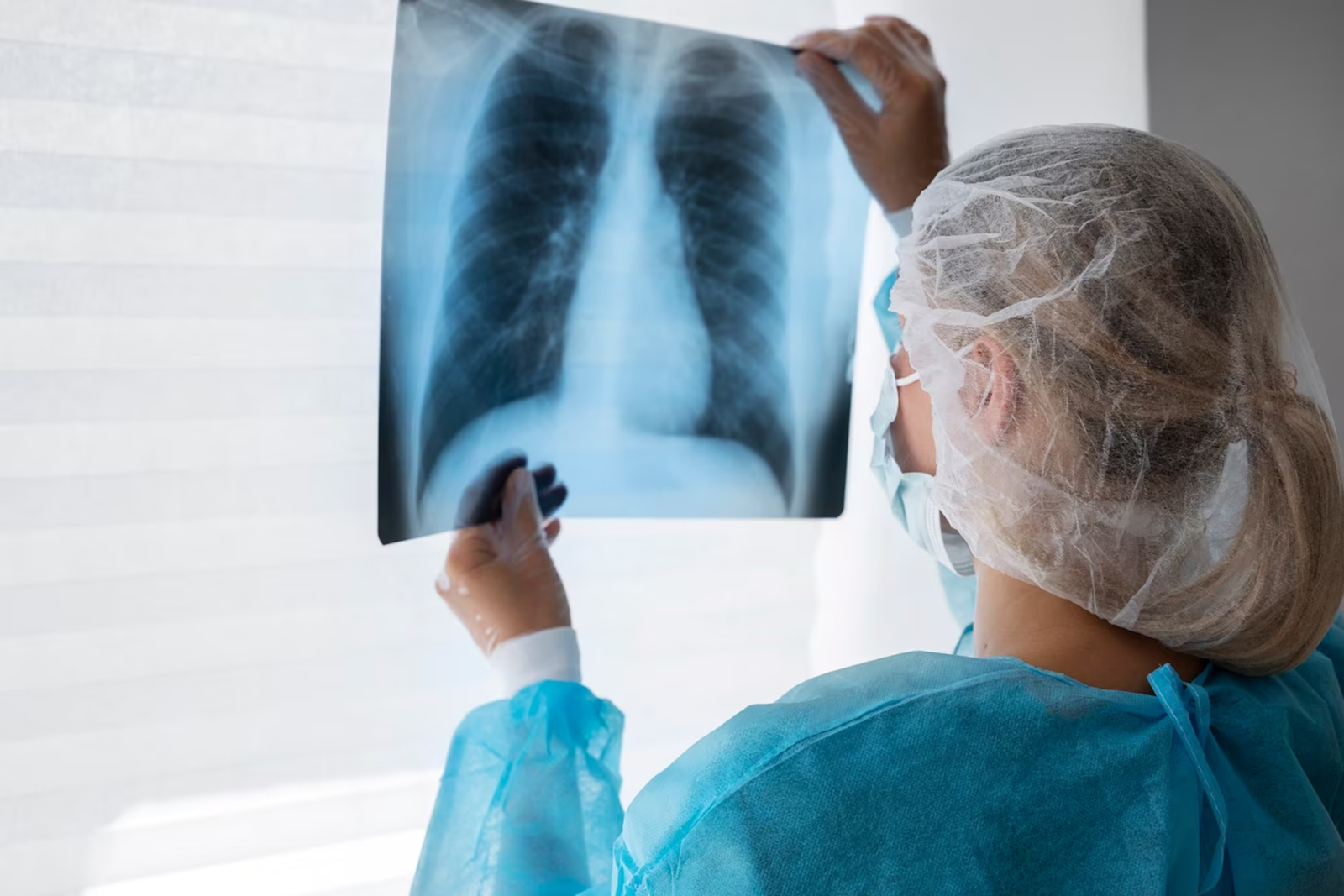 Doctora mirando una prueba de cáncer de pulmón